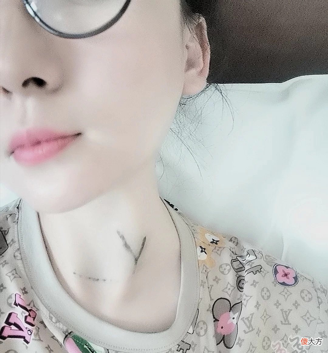 患者自述2019年前的体检，甲状腺结节基本都保持在0.4公分左右