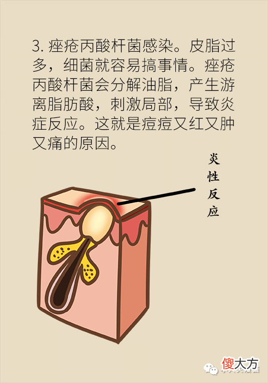 【时尚一点】痘痘反复就是好不了？可能因为做错了这件事