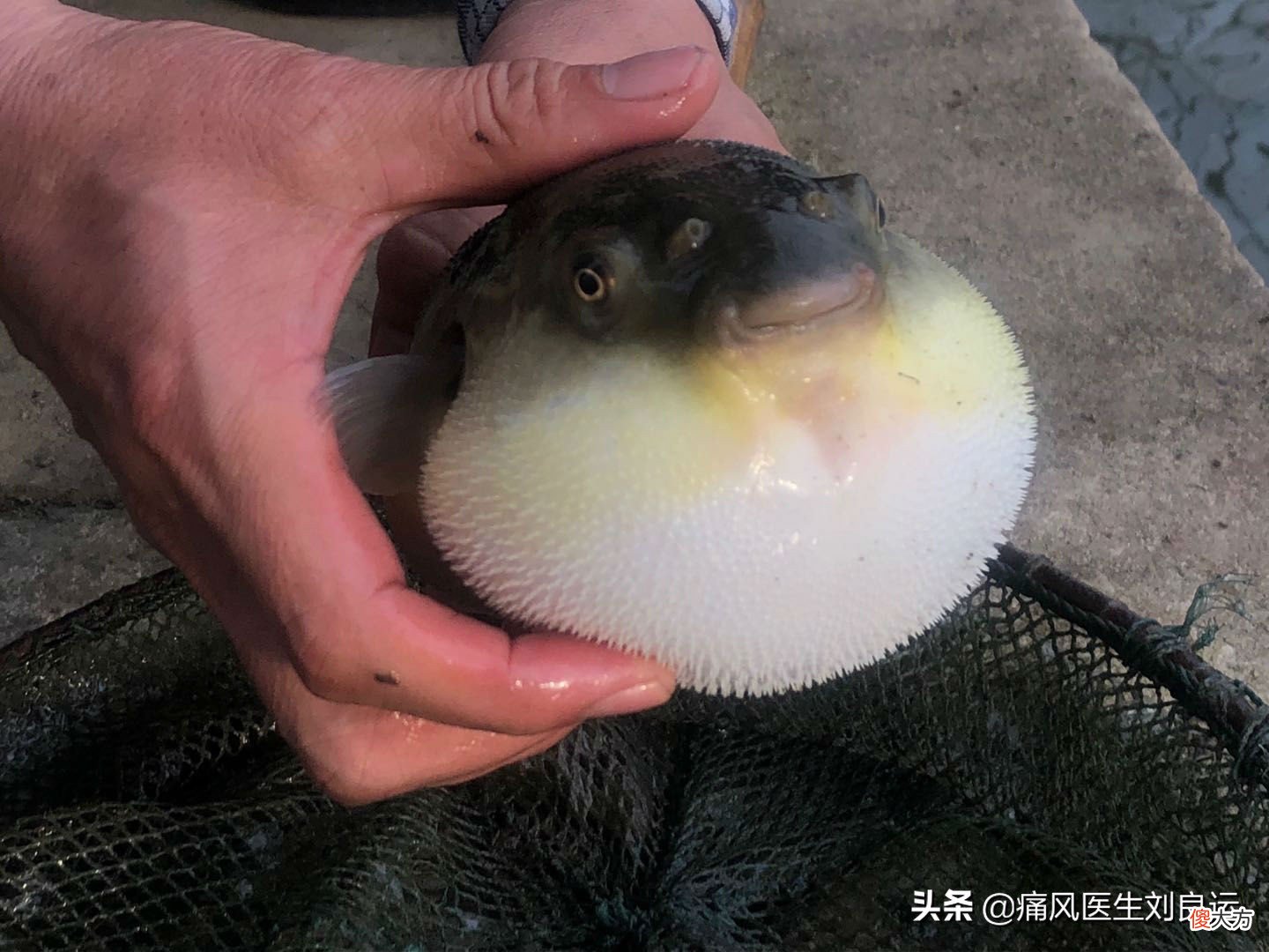 香椿、地菜皮、芥菜等春季时令菜，痛风患者可以吃哪些？怎么吃？