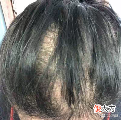 这些方法真的可以生发防脱，赶紧get起来~