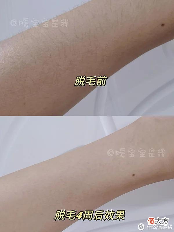 【时尚一点】【慕金Pure Mini开箱测评】脱毛仪真的有用吗？脱毛仪能永远脱毛吗？慕金Pure Mini实测，保姆级使用攻略