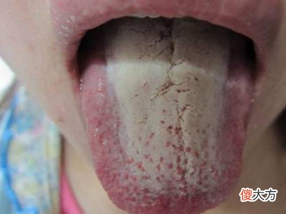 孩子脾虚积食，身体不会“说谎”，会发出8个求救信号，父母要引起重视