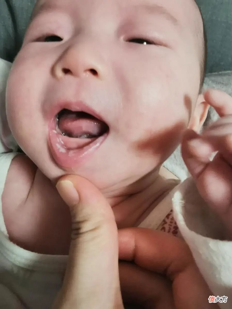 宝宝鹅口疮怎么办？我用 2 个月的时间得出答案