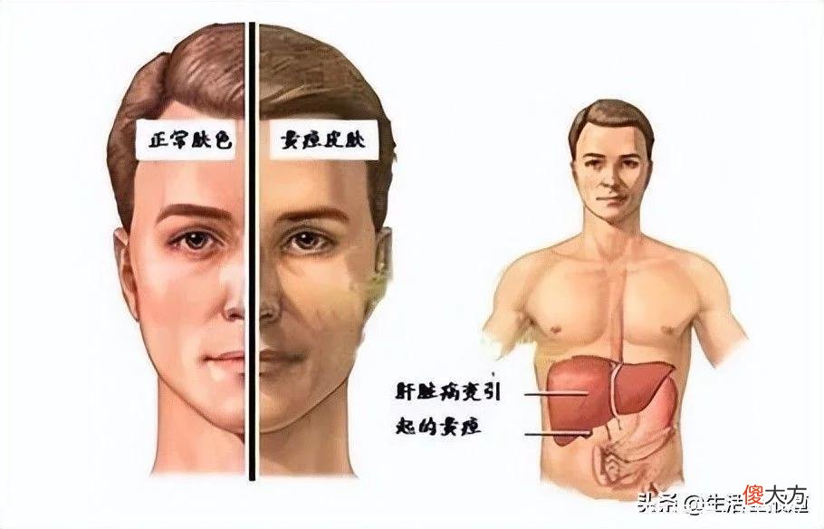 【就爱时尚】爱美人士要警惕！一女子疑似纹眉感染乙肝