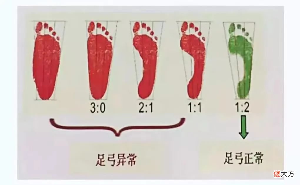 央视曝光！这种童鞋“雌激素”超标470倍！家里有的赶紧扔