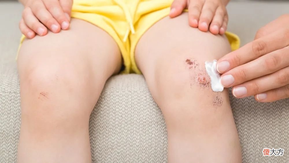 孩子蚊子包、红屁屁用红霉素软膏？医生：住手！乱用有危险