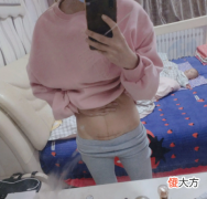 剖腹产选择美容线好还是拆线的好？4点区别，并不是越贵越好