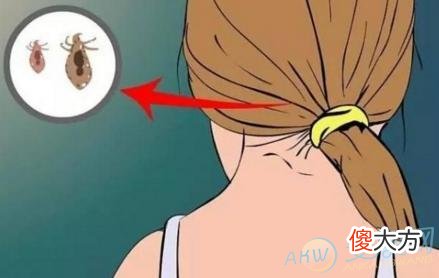 梦境解读-梦见头上有虫子象征含义分析(图文)