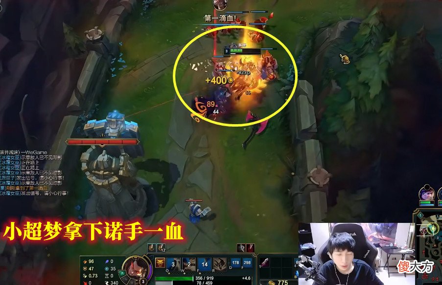 【游戏迷】小超梦用劲夫打诺手，口出狂言：能打30米远的大拳，见过没有？