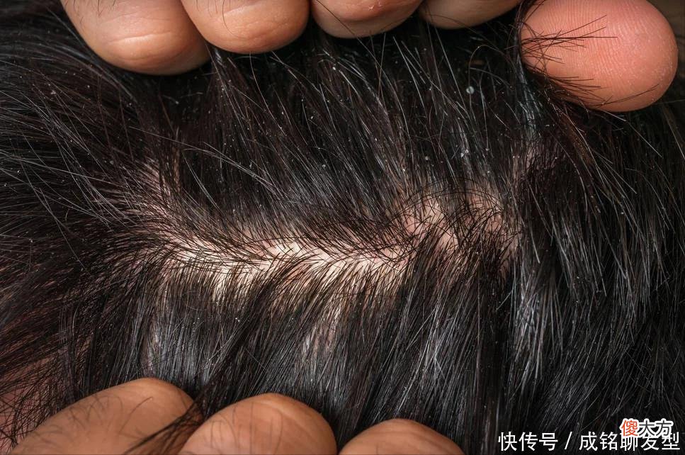 【就爱时尚】洗发时不用洗发水，头发会变得更好吗？你相信吗？你会跟风吗？