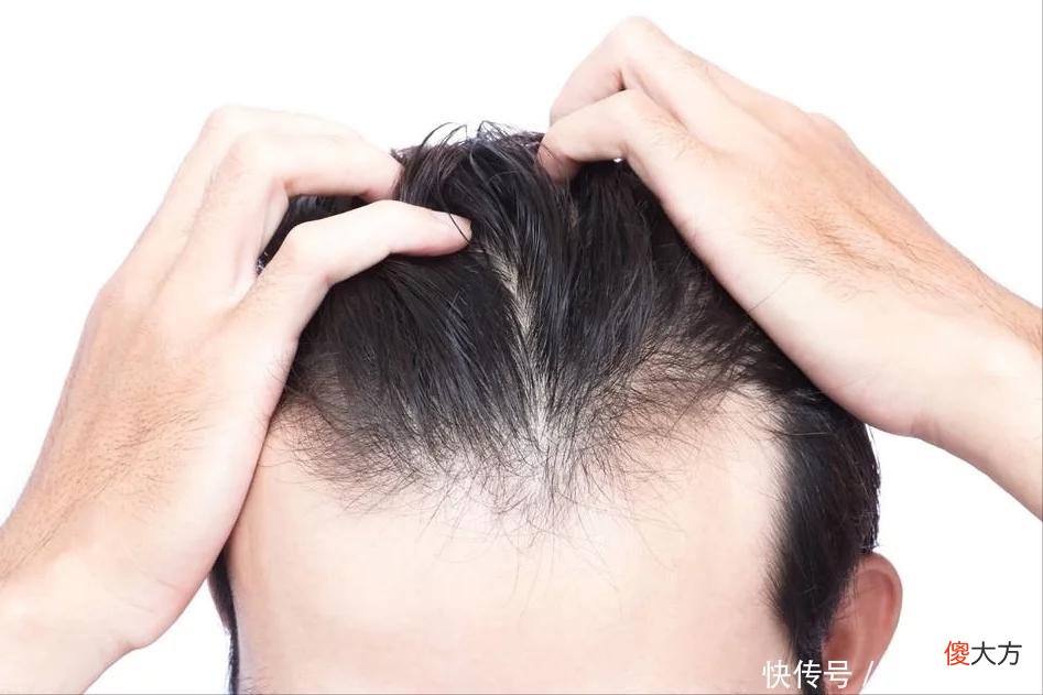 【就爱时尚】洗发时不用洗发水，头发会变得更好吗？你相信吗？你会跟风吗？