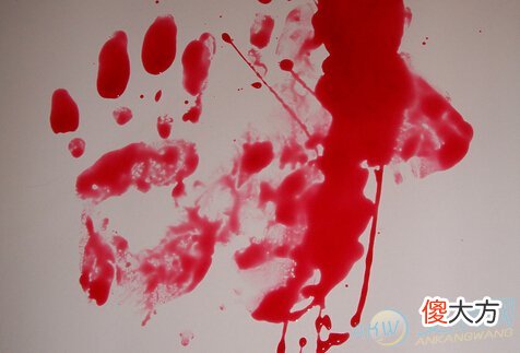 做梦梦见血并非凶兆 详解梦境含义(图文)