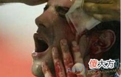 梦见把别人头打破流血代表着什么？(图文)
