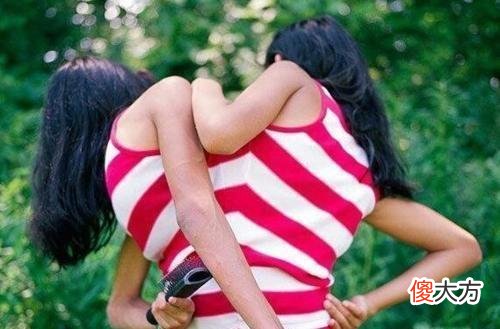 墨西哥连体姐妹合用身體18年，坚强靓丽的两姐妹经历很是令人感动