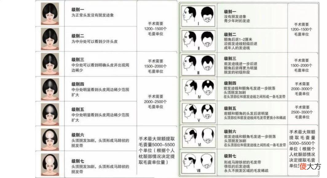 【就爱时尚】有多少男人愿意为地中海花钱？