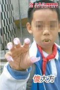 梦见同学变僵尸咬人(图文)