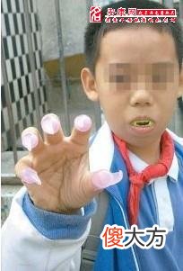 梦见同学变僵尸咬人(图文)