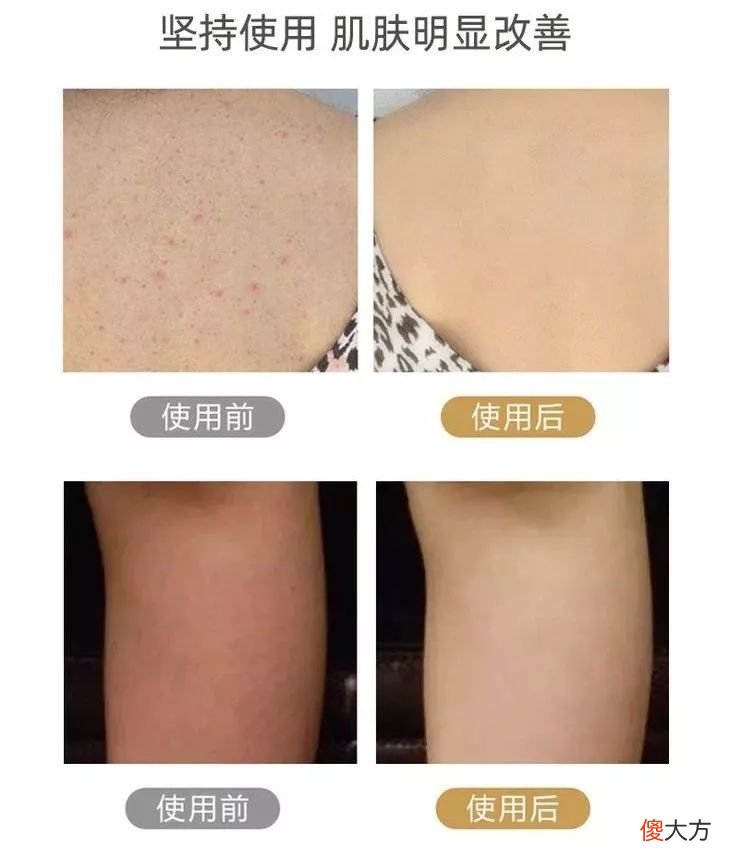 【就爱时尚】2元一块的硫磺皂，明明有这么多好处，却因便宜被很多人瞧不上