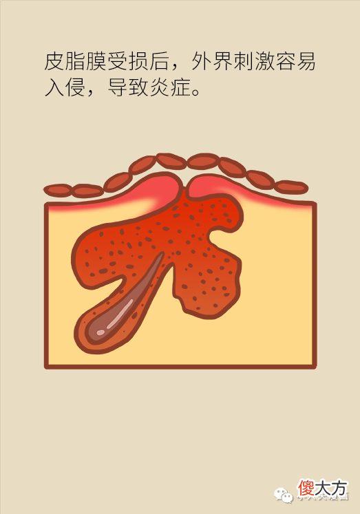 【就爱时尚】自从我改了这个动作，脸上再没长过痘痘