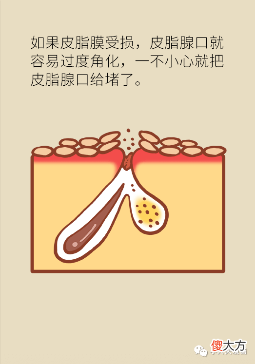 【就爱时尚】自从我改了这个动作，脸上再没长过痘痘