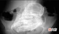 4岁男孩竟然离奇怀孕！真相太吓人