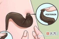 做梦梦见蚂蟥好不好(图文)