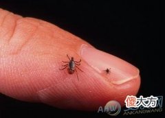 梦见自己身上有虱子(图文)