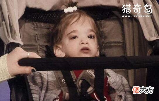 不老女婴20岁仍然是婴儿，不老女婴拥有人类永生的关键