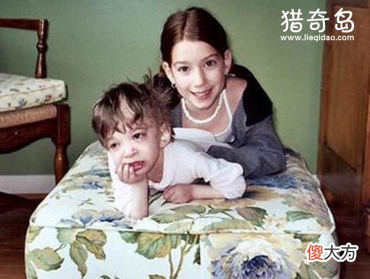 不老女婴20岁仍然是婴儿，不老女婴拥有人类永生的关键