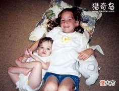 不老女婴20岁仍然是婴儿，不老女婴拥有人类永生的关键