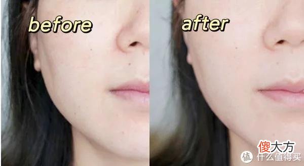 【时尚一点】理性买买买 篇一：35+阿姨新入手的巧本双头八极射频美容仪，真人实测，到底好不好用？值不值得入手？