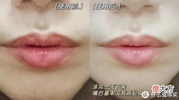 【时尚一点】夏日唇部怎么护养?保湿防晒不能忘!